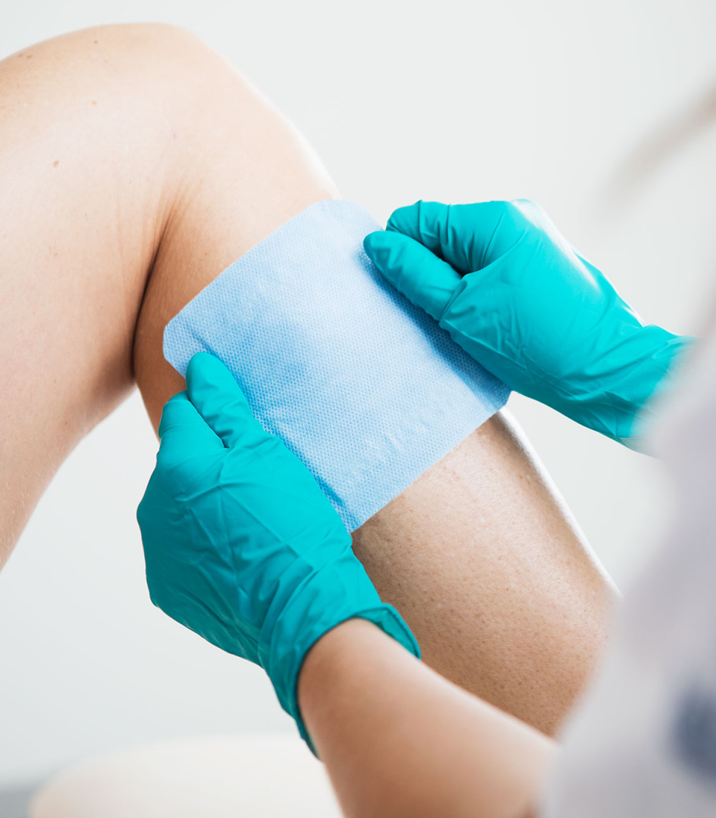 DryMax Blue a superabsorbent dressing from Absorbest