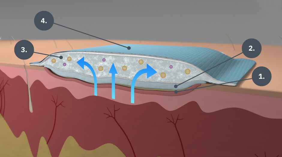 egenskaper i ett superabsorberande skumförband.