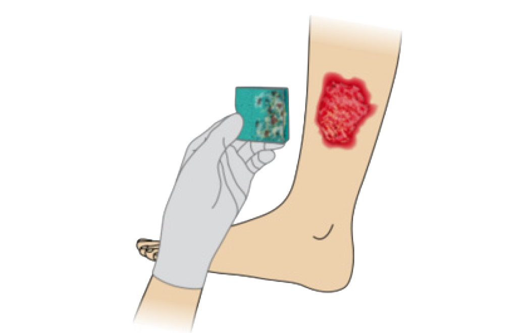 Ligasano with leg