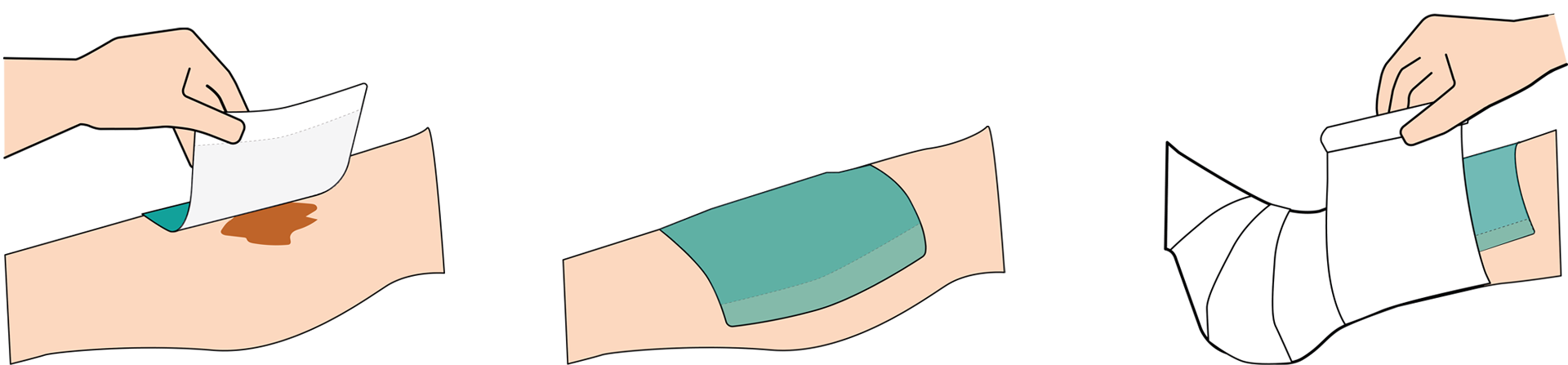 Absorbest BioShield applikationsguide