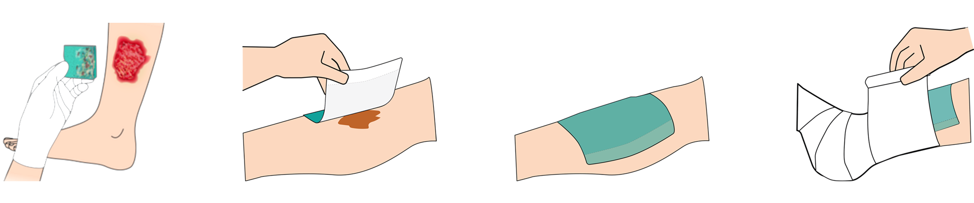 Absorbest BioShield appliceringsguide